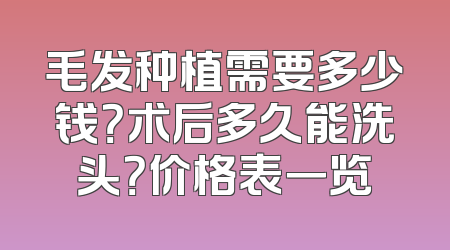毛发种植需要多少钱？术后多久能洗头？价格表一览