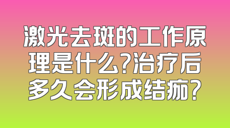 激光去斑的工作原理是什么？治疗后多久会形成结痂？