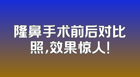隆鼻手术前后对比照，效果惊人！