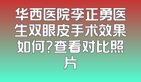 华西医院李正勇医生双眼皮手术效果如何？查看对比照片