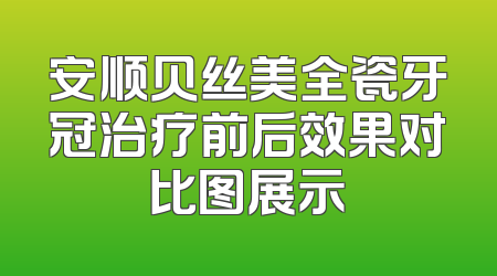 安顺贝丝美全瓷牙冠治疗前后效果对比图展示