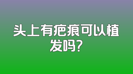 头上有疤痕可以植发吗？