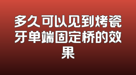 多久可以见到烤瓷牙单端固定桥的效果