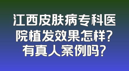 江西皮肤病专科医院植发效果怎样？有真人案例吗？