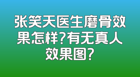 张笑天医生磨骨效果怎样？有无真人效果图？
