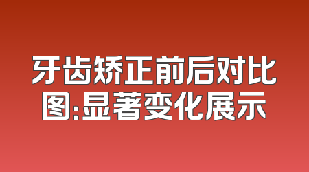 牙齿矫正前后对比图：显著变化展示