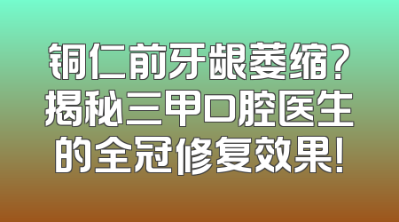 铜仁前牙龈萎缩？揭秘三甲口腔医生的全冠修复效果！