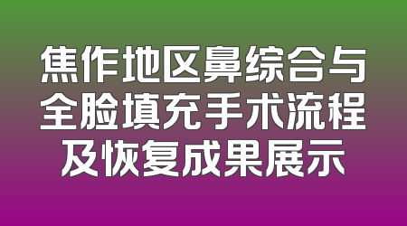 焦作地区鼻综合与全脸填充手术流程及恢复成果展示