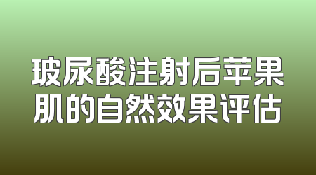 玻尿酸注射后苹果肌的自然效果评估
