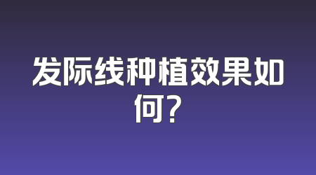 发际线种植效果如何？