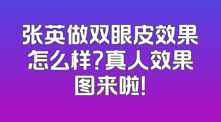 张英做双眼皮效果怎么样？真人效果图来啦！