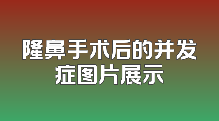 隆鼻手术后的并发症图片展示