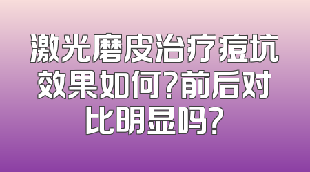 激光磨皮治疗痘坑效果如何？前后对比明显吗？