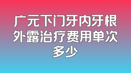 广元下门牙内牙根外露治疗费用单次多少