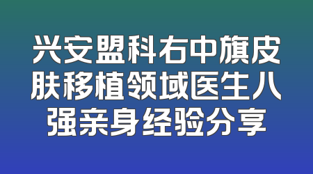 兴安盟科右中旗皮肤移植领域医生八强亲身经验分享