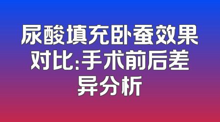 尿酸填充卧蚕效果对比：手术前后差异分析