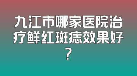 九江市哪家医院治疗鲜红斑痣效果好？