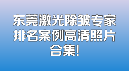 东莞激光除皱专家排名案例高清照片合集！