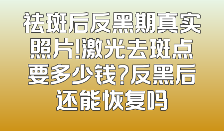 祛斑后反黑期真实照片！激光去斑点要多少钱？反黑后还能恢复吗