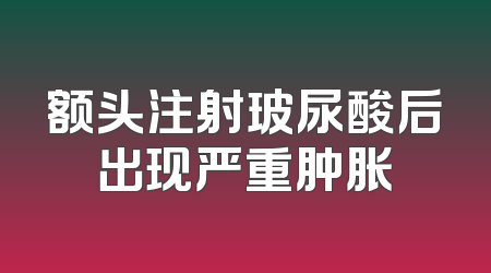 额头注射玻尿酸后出现严重肿胀