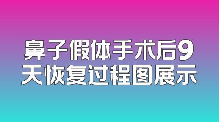 鼻子假体手术后9天恢复过程图展示