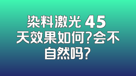染料激光 45 天效果如何？会不自然吗？