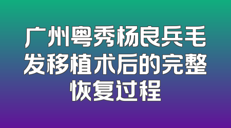 广州粤秀杨良兵毛发移植术后的完整恢复过程