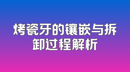 烤瓷牙的镶嵌与拆卸过程解析