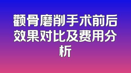 颧骨磨削手术前后效果对比及费用分析