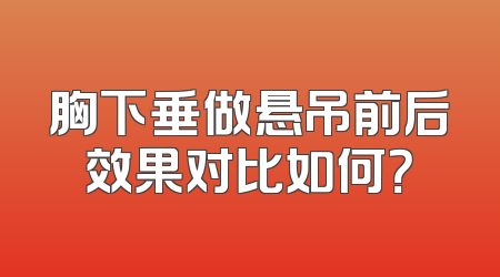 胸下垂做悬吊前后效果对比如何？