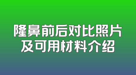 隆鼻前后对比照片及可用材料介绍