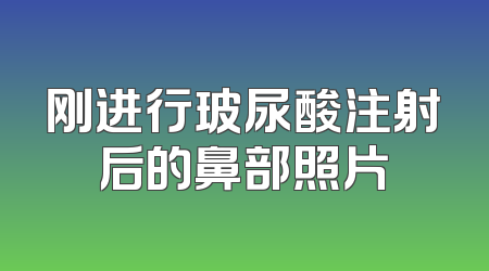 刚进行玻尿酸注射后的鼻部照片
