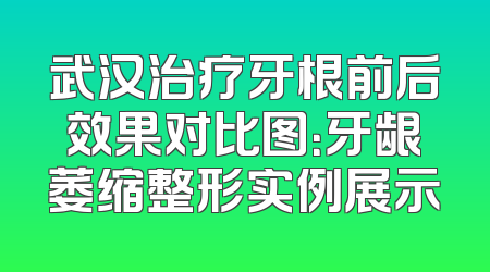 武汉治疗牙根前后效果对比图：牙龈萎缩整形实例展示