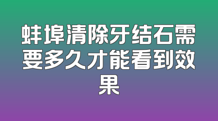 蚌埠清除牙结石需要多久才能看到效果