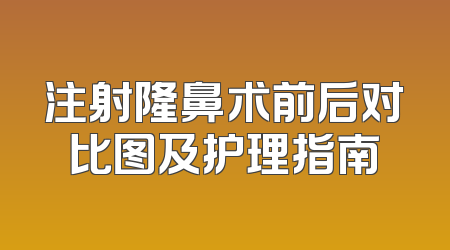 注射隆鼻术前后对比图及护理指南