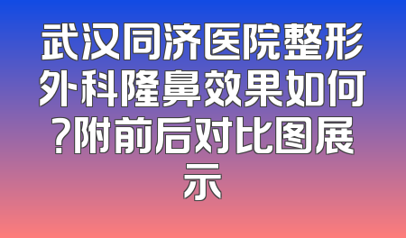 武汉同济医院整形外科隆鼻效果如何？附前后对比图展示