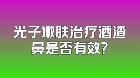 光子嫩肤治疗酒渣鼻是否有效？