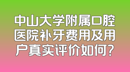 中山大学附属口腔医院补牙费用及用户真实评价如何？