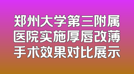 郑州大学第三附属医院实施厚唇改薄手术效果对比展示
