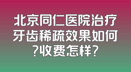 北京同仁医院治疗牙齿稀疏效果如何？收费怎样？