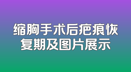 缩胸手术后疤痕恢复期及图片展示