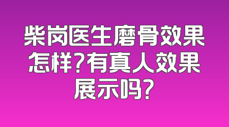 柴岗医生磨骨效果怎样？有真人效果展示吗？