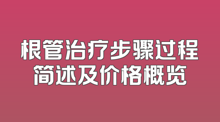 根管治疗步骤过程简述及价格概览