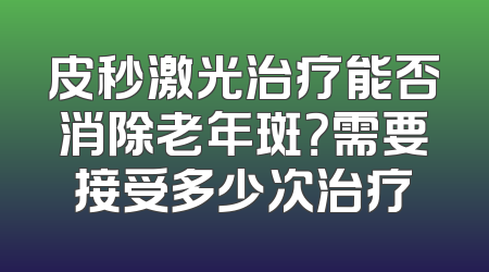 皮秒激光治疗能否消除老年斑？需要接受多少次治疗