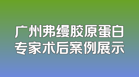 广州弗缦胶原蛋白专家术后案例展示