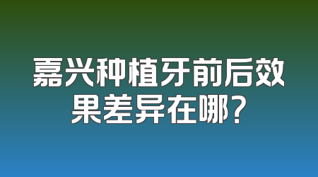 嘉兴种植牙前后效果差异在哪？