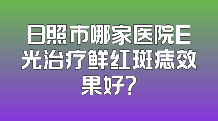 日照市哪家医院E光治疗鲜红斑痣效果好？