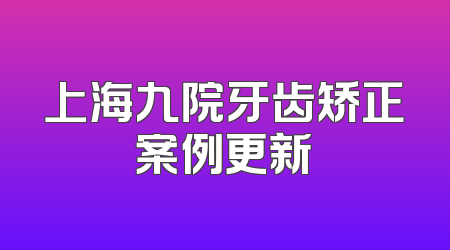 上海九院牙齿矫正案例更新