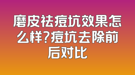 磨皮祛痘坑效果怎么样？痘坑去除前后对比