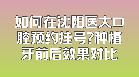 如何在沈阳医大口腔预约挂号？种植牙前后效果对比